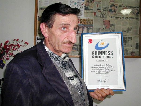 Житель Туреччини визнаний власником найдовшого у світі носа