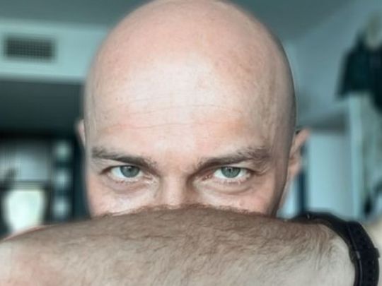 Бандит, Джим Керрі та Зідан в одній особі: поголений Яма шокував фанатів