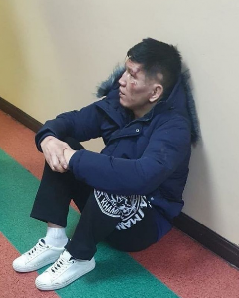«Вм'ятий череп, нічого не пам'ятає»: бійця ММА по-звірячому побили за критику влади в Казахстані