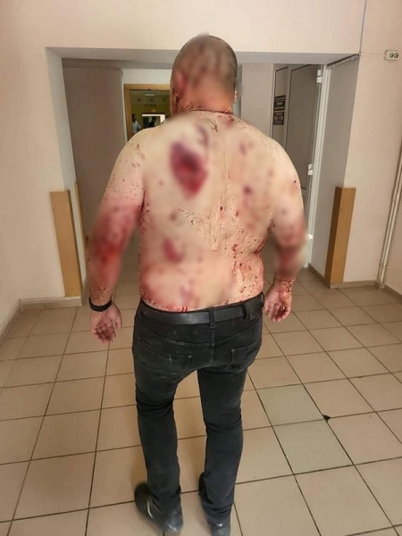 «Я побачив дитячі кістки в машині, що згоріла»: про трагедію у Вінниці розповіли її свідки та родичі загиблих