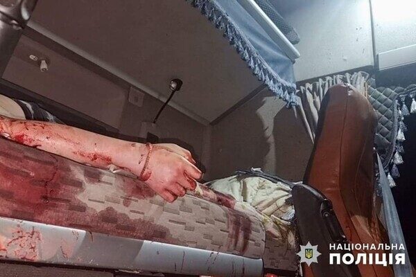 Враг атаковал Одесский район баллистикой: есть раненые и погибшие, среди жертв &ndash; десятилетняя девочка (обновлено)